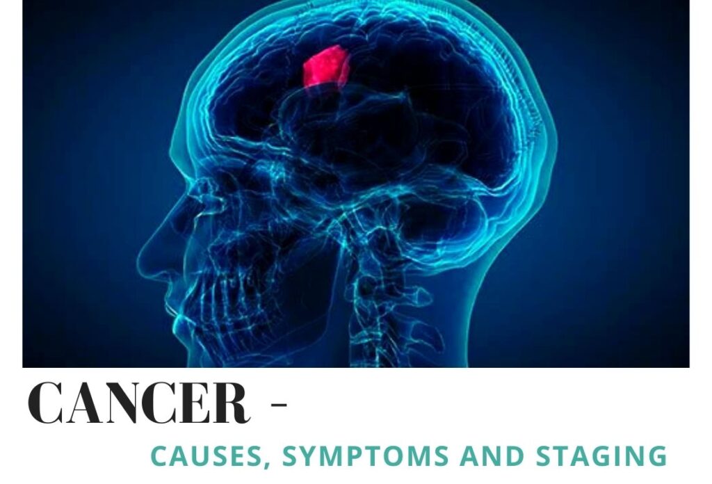 best hospital for cancer treatment