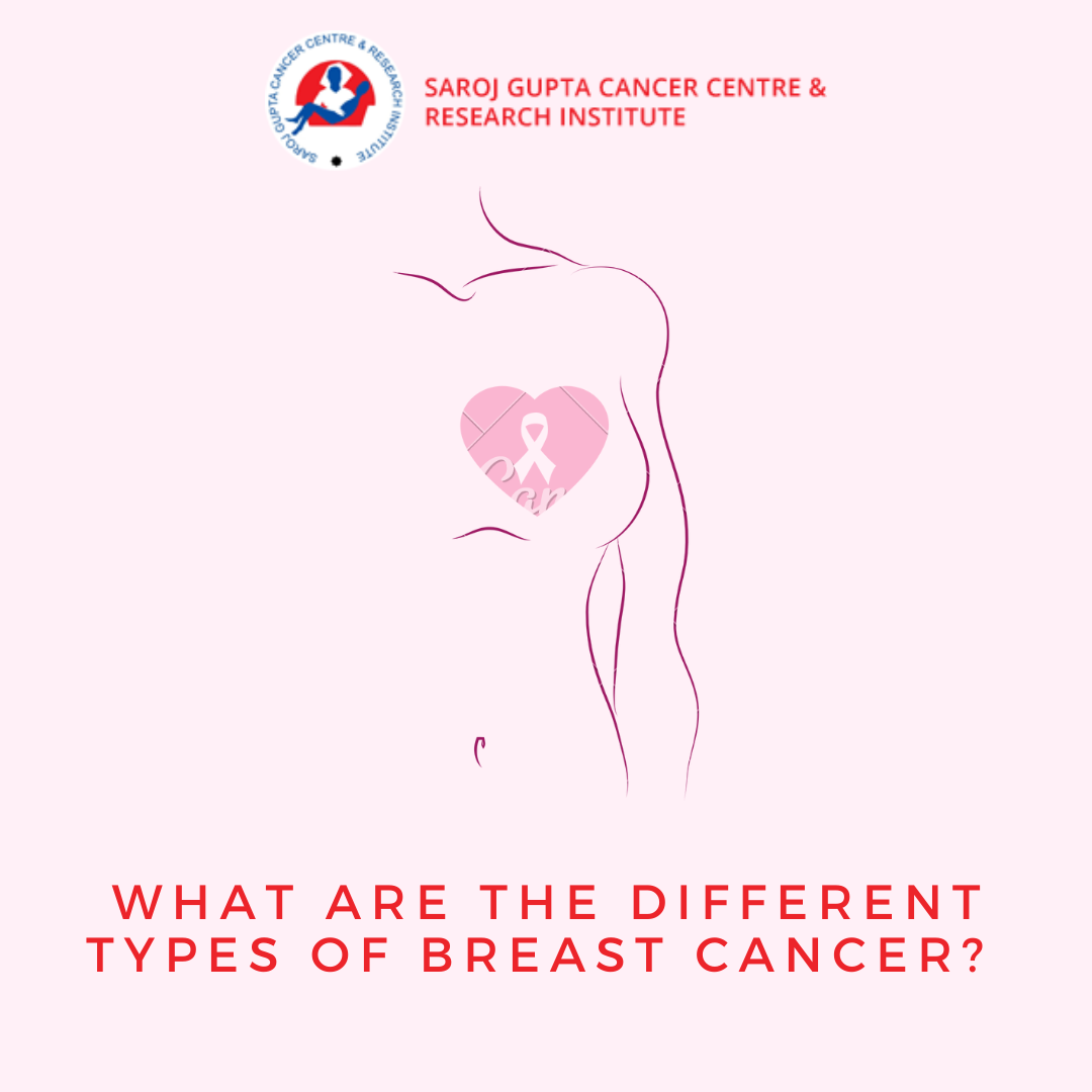 best breast cancer treatment Kolkata