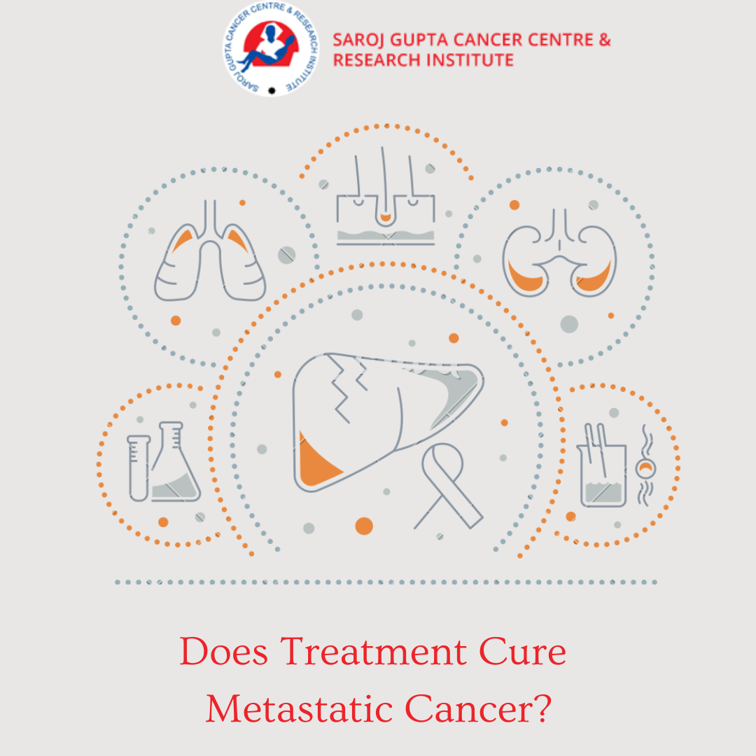 metastatic cancer treatment