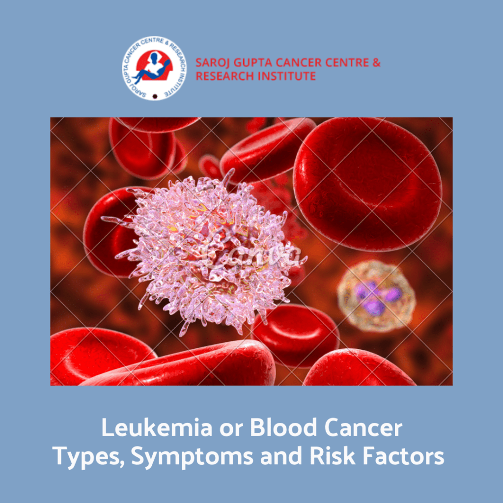 Leukemia Or Blood Cancer Types Symptoms And Risk Factors