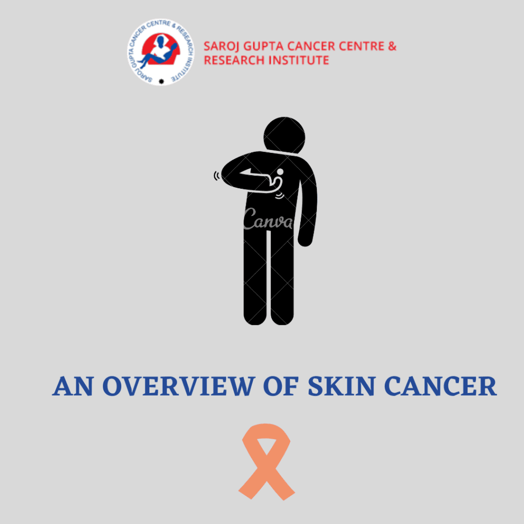 Skin Cancer