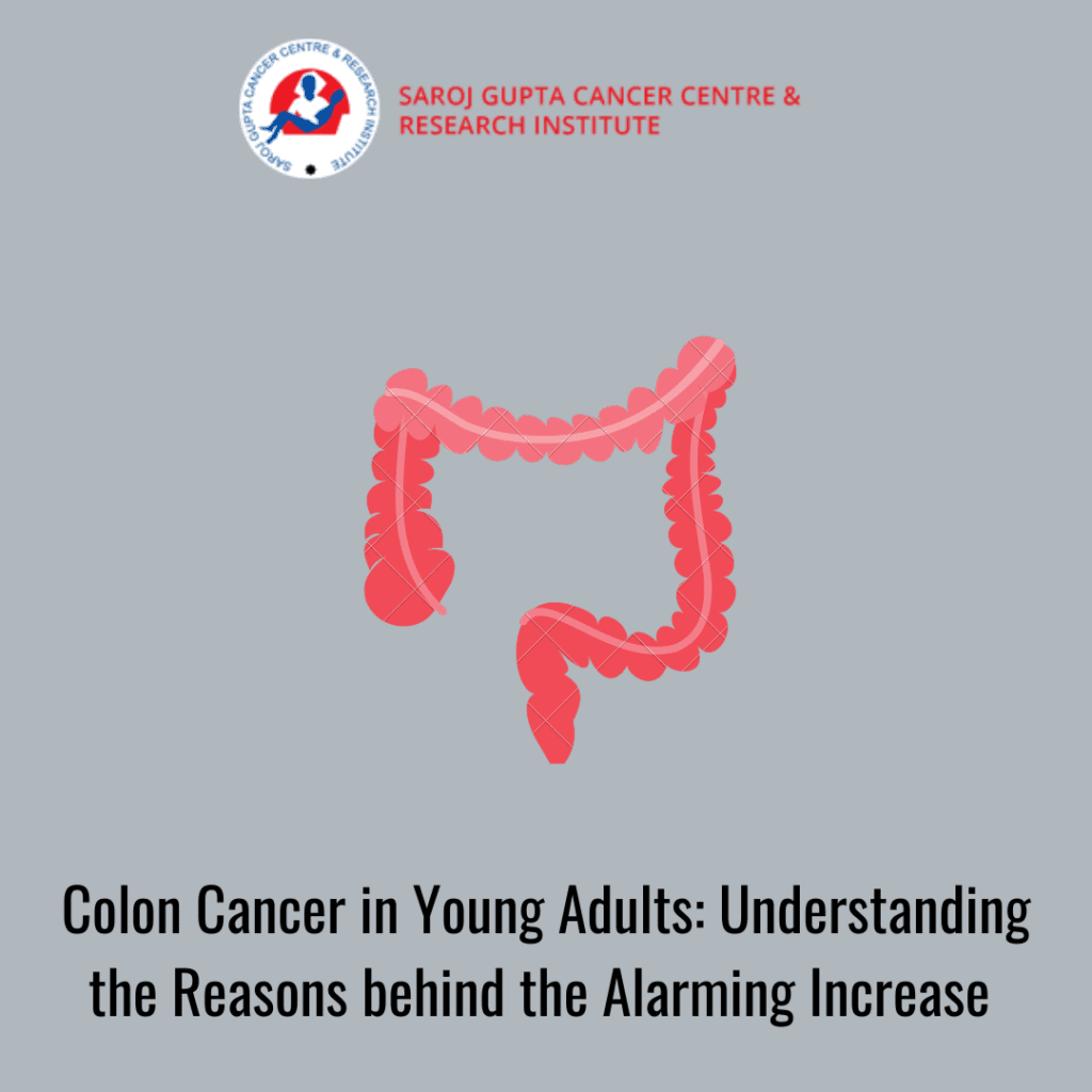 colon cancer