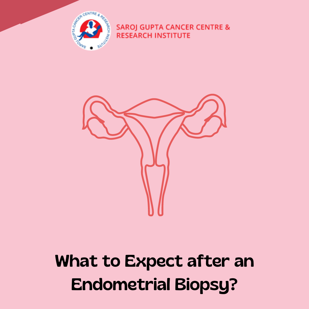 Endometrial Biopsy