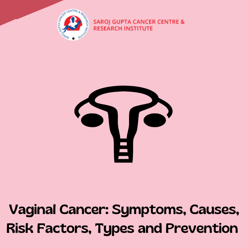 Vaginal Cancer Symptoms Causes Types And Prevention