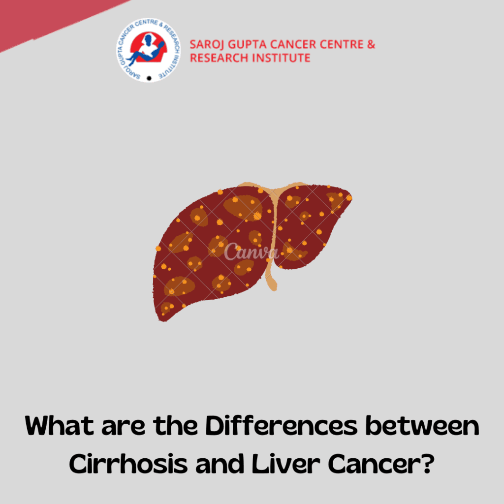 what-are-the-differences-between-cirrhosis-and-liver-cancer