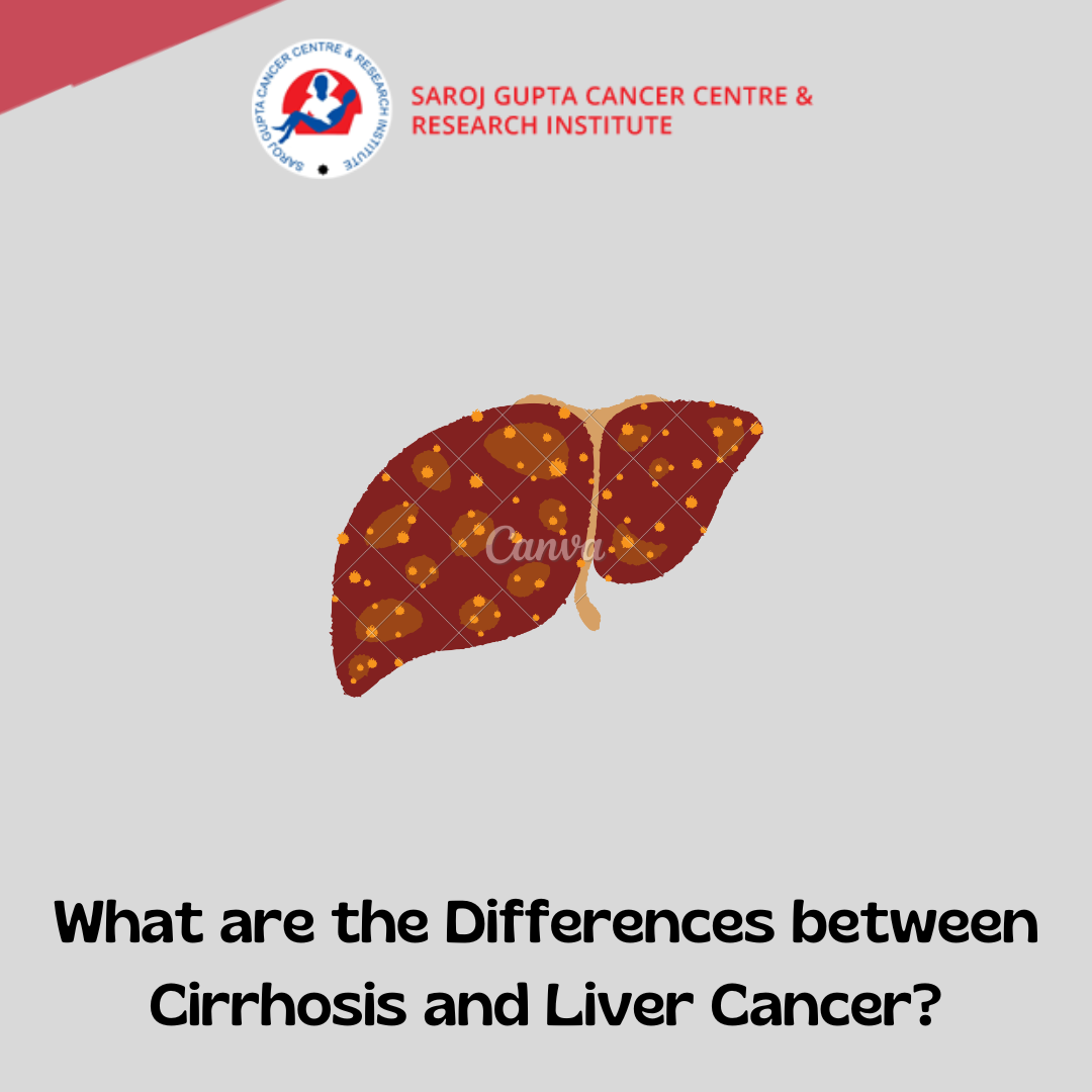 liver cancer