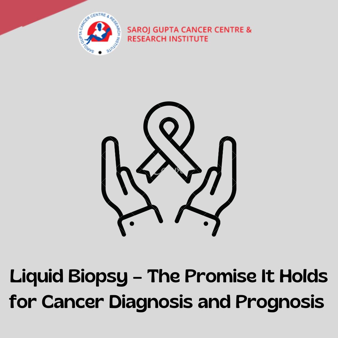 liquid-biopsy-the-promise-it-holds-for-cancer-diagnosis-prognosis