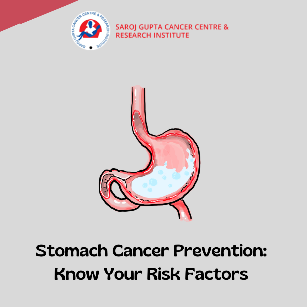 stomach cancer