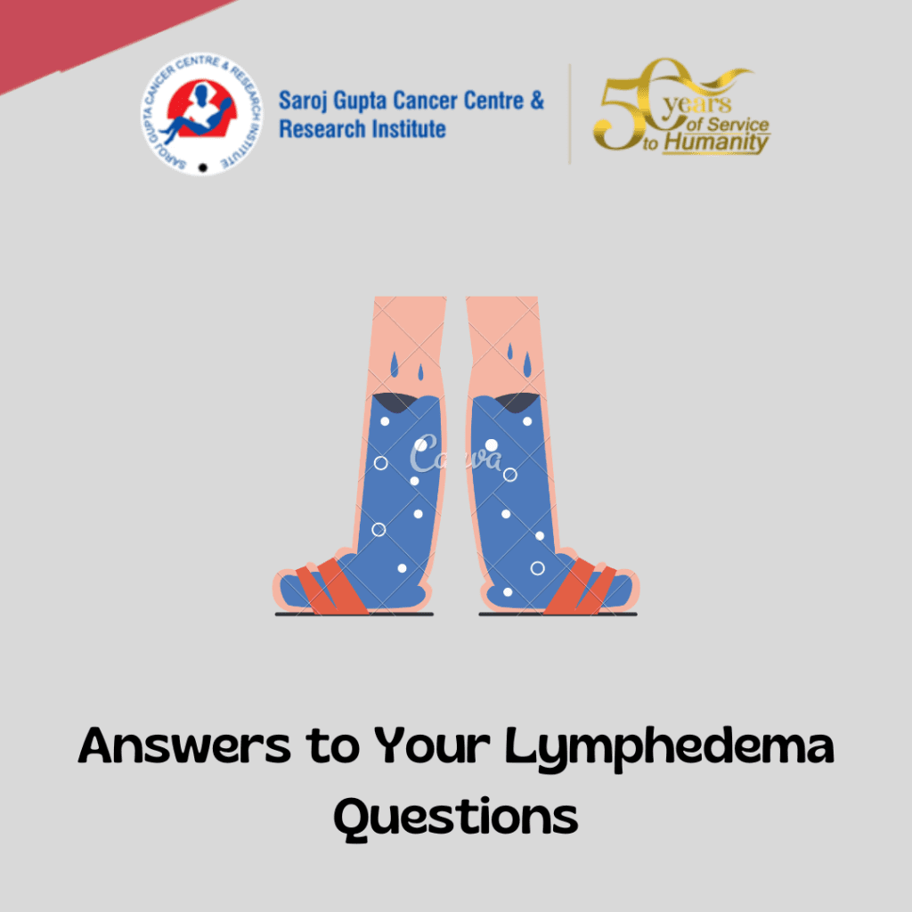lymphedema